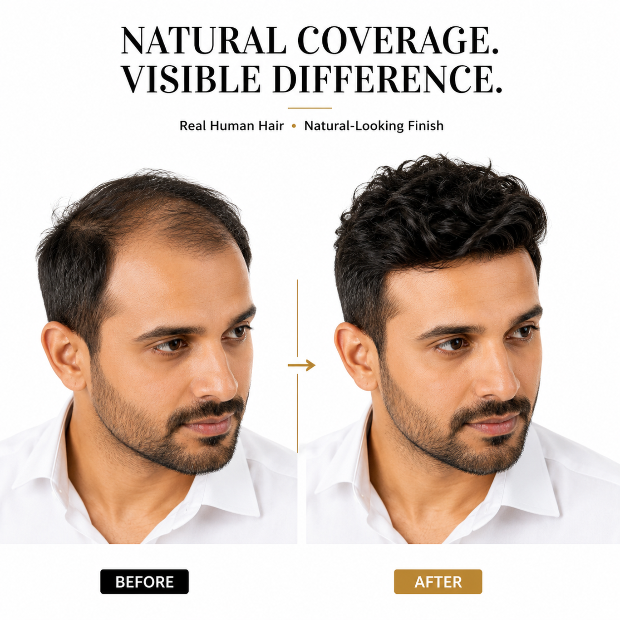 Hairzo Mirage Skin Base Hair Patch for Men – 100% Human Hair with Wide PU Border