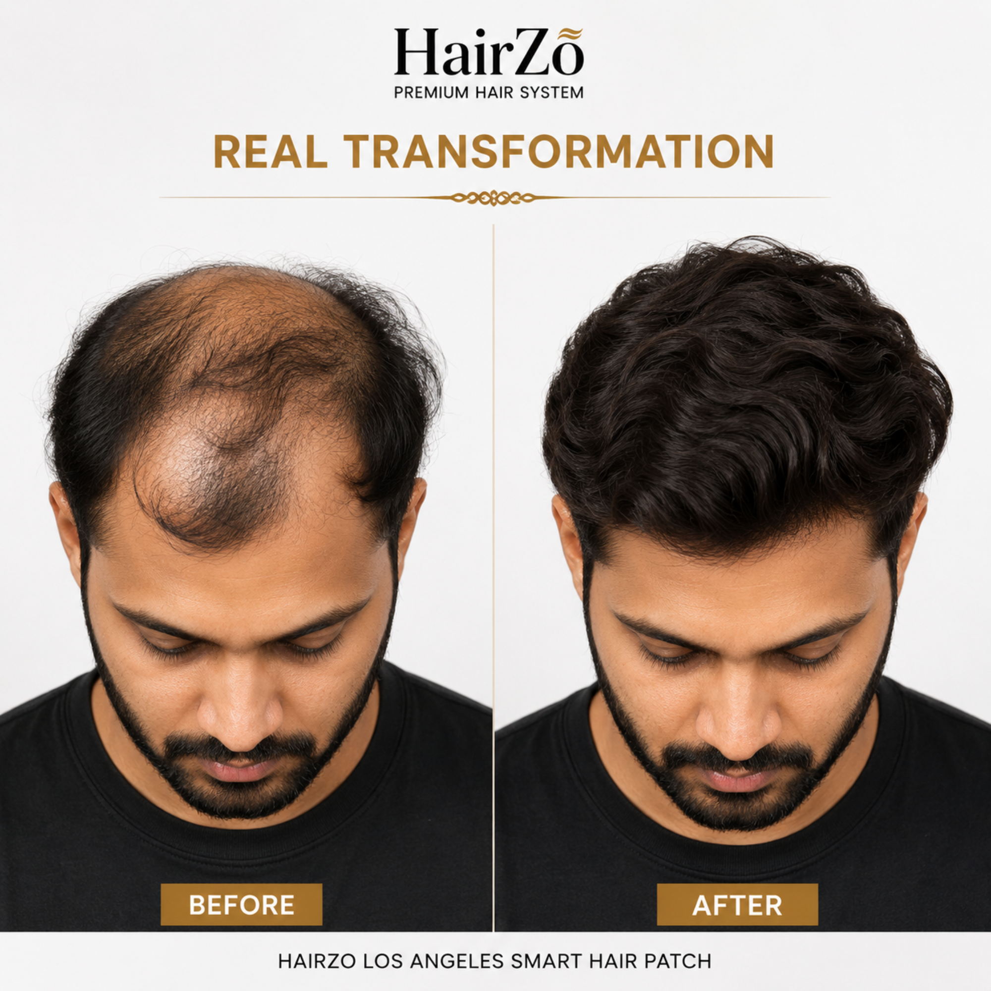 Hairzo LOS ANGELES Smart Hair Patch for Men | Real Human Hair Mono Lace Toupee with Breathable Base & Slim PU Perimeter | Natural Hair Replacement System