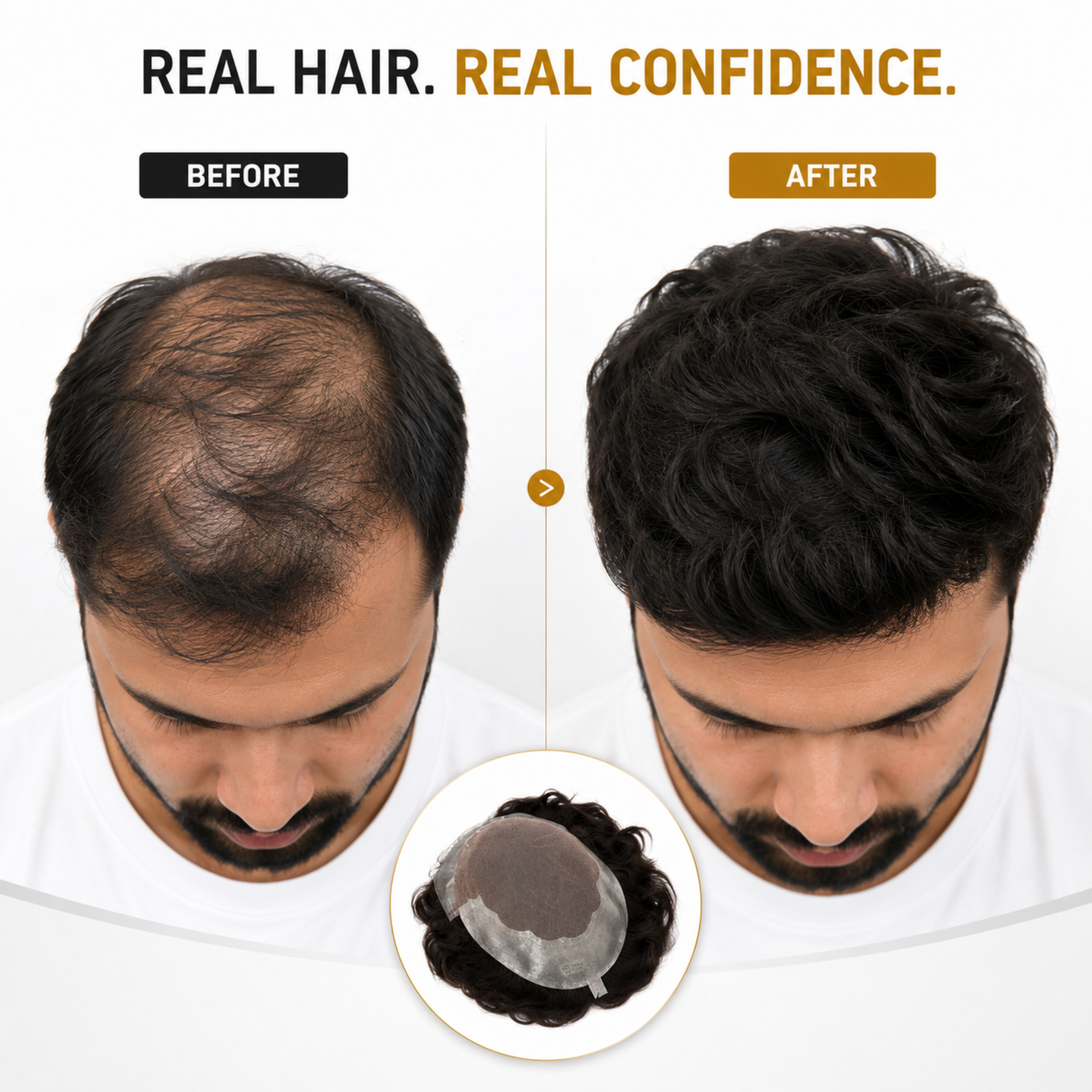 Hairzo Q6 Hair Patch for Men | French Lace Human Hair Toupee with Ultra Thin 4D Lace & Flexible PU Base | Natural Hair Replacement System for Men
